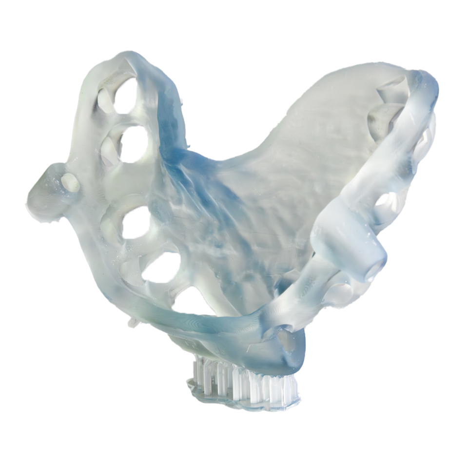 Alias Dental Surgical Guide