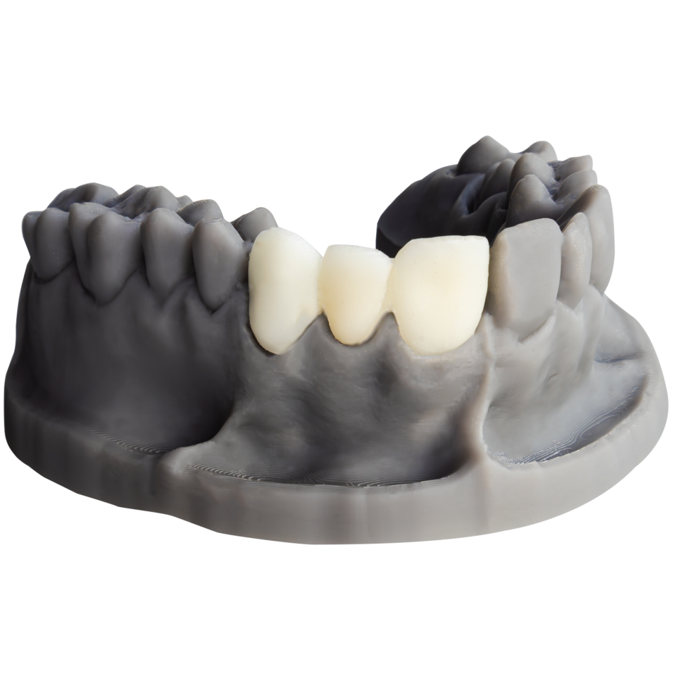 Alias Dental Temp C&B