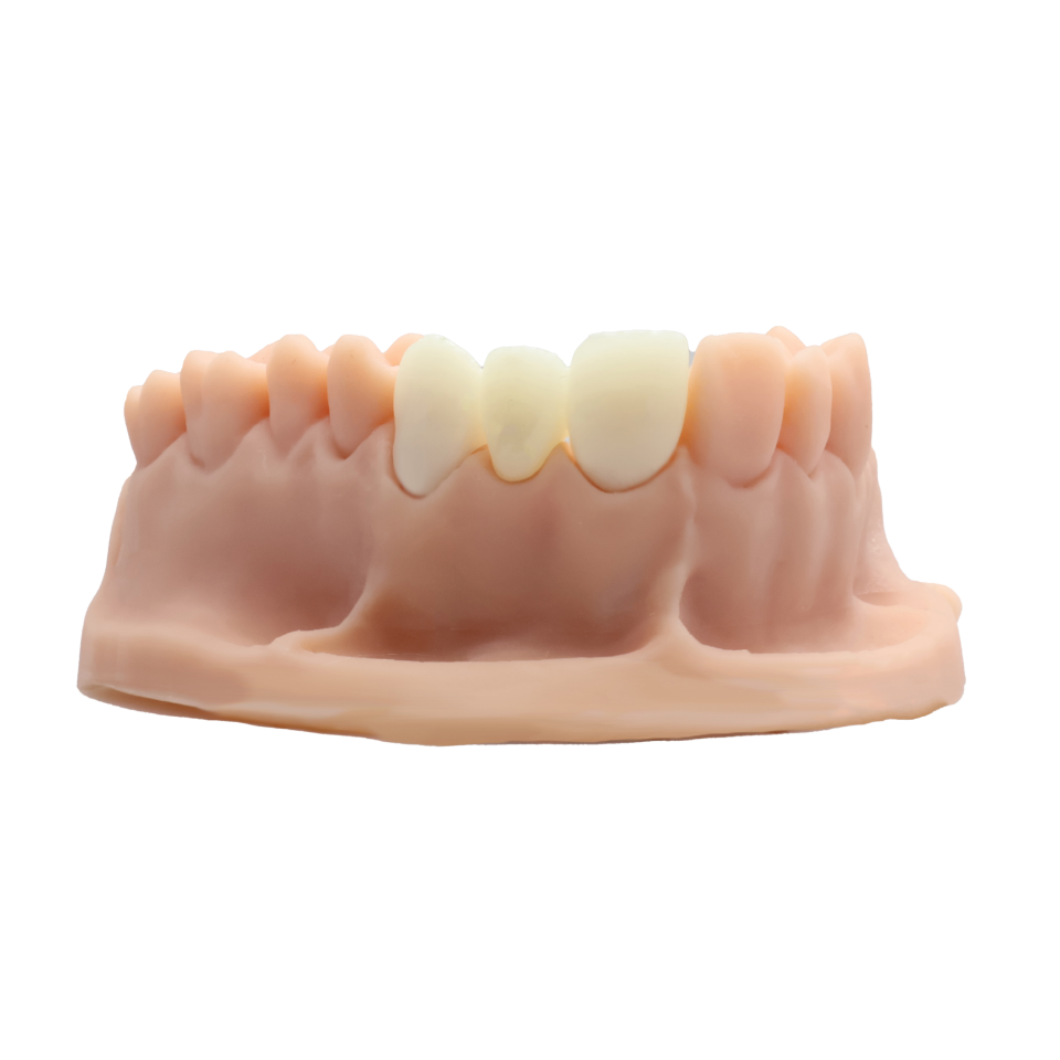 Alias Dental Temp C&B
