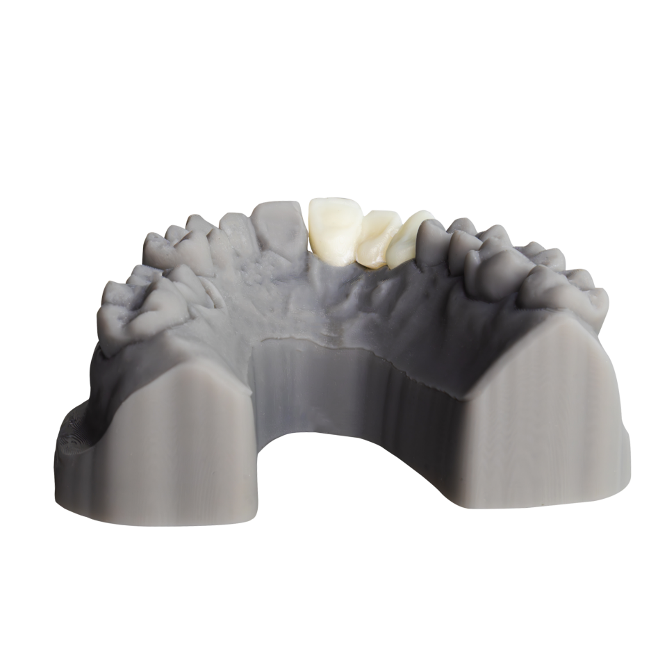 Alias Dental Temp C&B