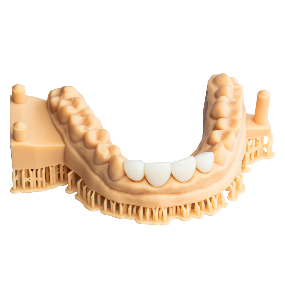 Alias Dental Temp MHF