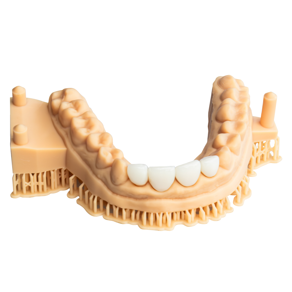 Alias Dental Temp MHF 1000G
